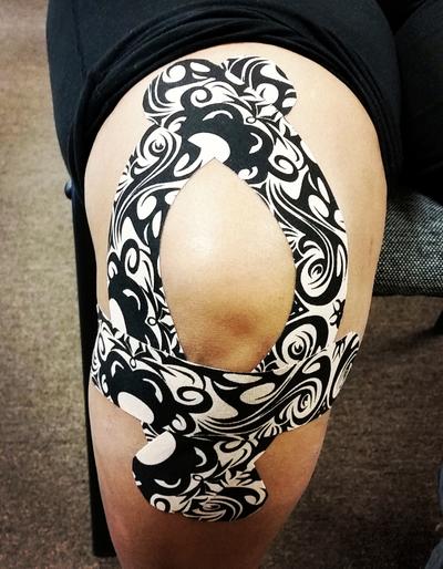 Knee with decorative black-and-white kinesiology tape applied